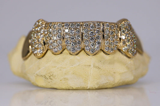 Capped Diamond Grillz Gold Silver Arian and Co arianandco